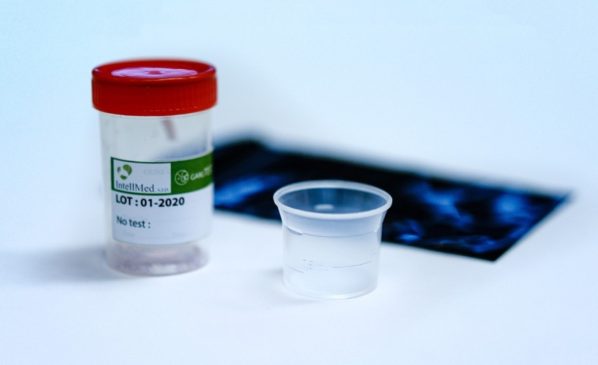 Češi vyvinuli domácí kloktací PCR test na covid-19